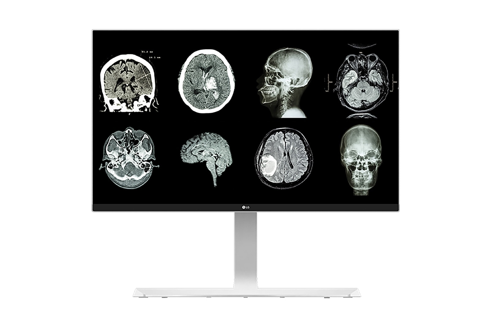 LG 27'' 8MP IPS Clinical Review Monitor, 27HJ712C-W