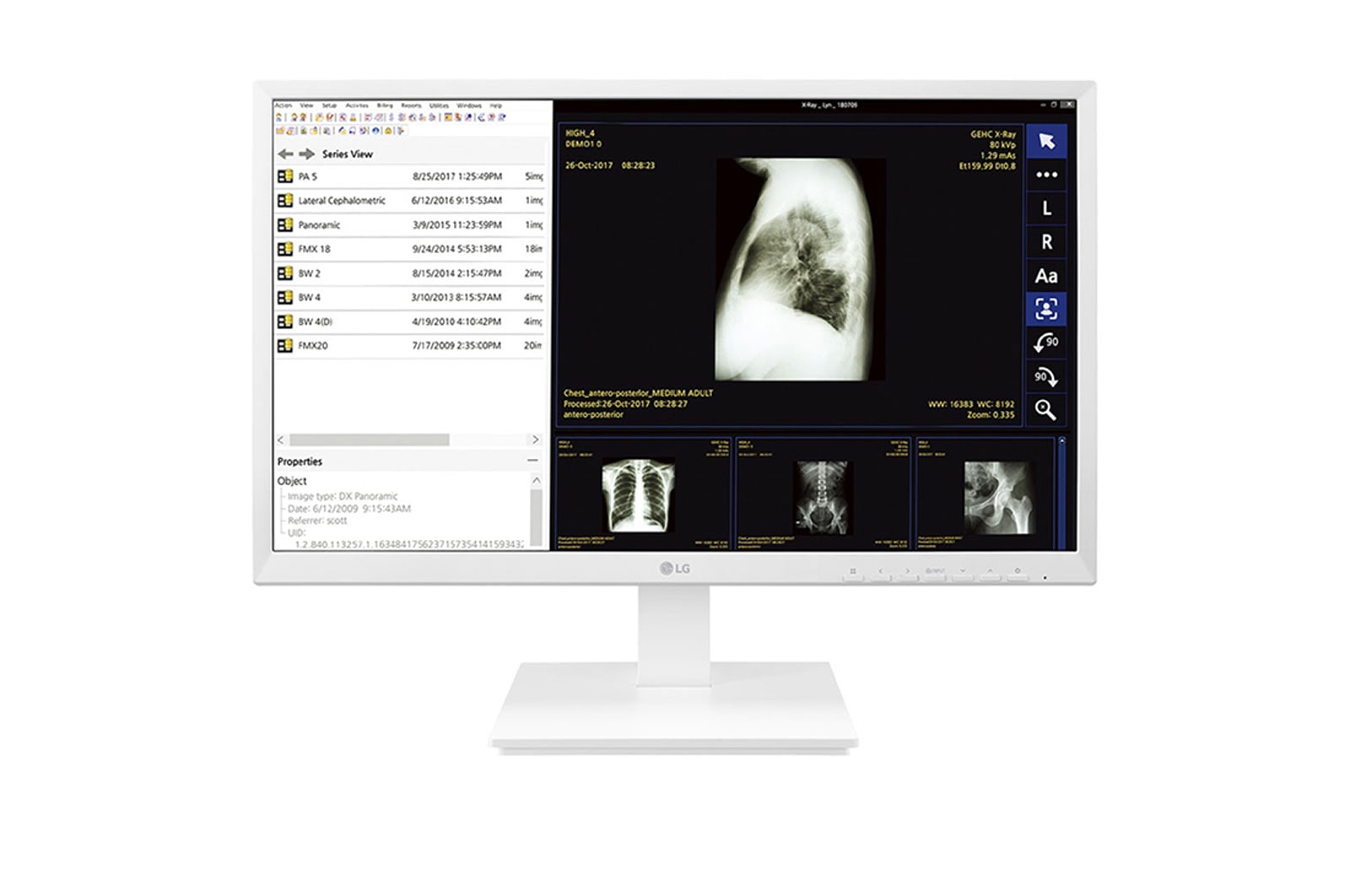 Front view of 24" All-in-One Thin Client for Healthcare 24CK560N-3A