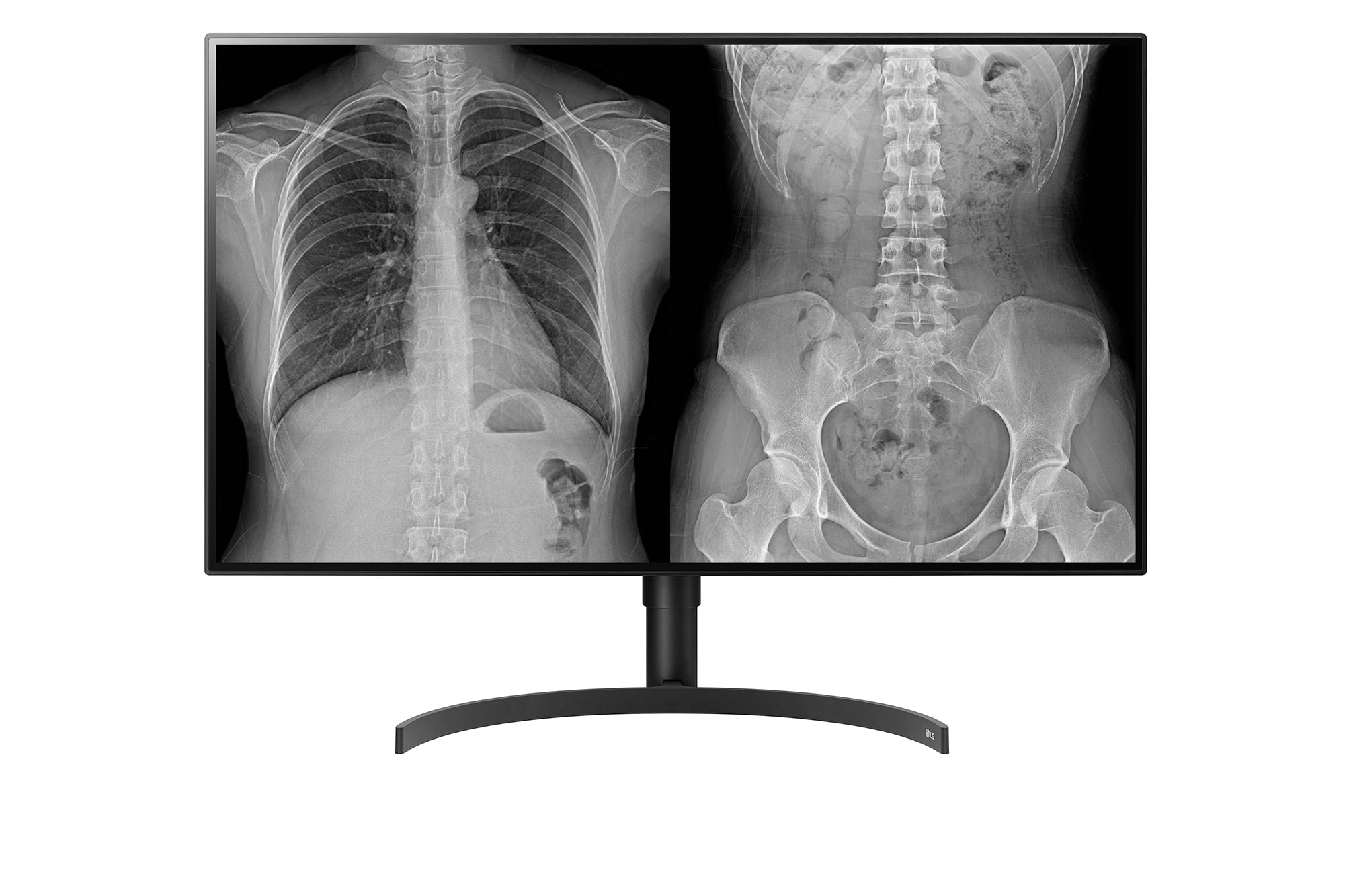 Front view of 31.5'' 8MP Diagnostic Monitor (32HL512D-M)