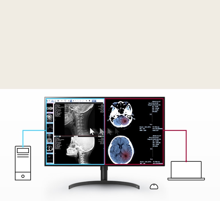 Multiple Signals on One Screen1