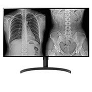 Front view of 31.5" LG 8MP Diagnostic Monitor 32HQ713D-B