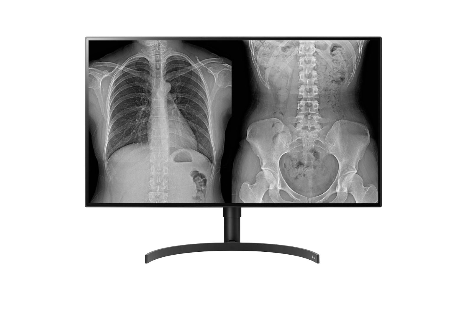 Front view of 31.5" LG 8MP Diagnostic Monitor 32HQ713D-B