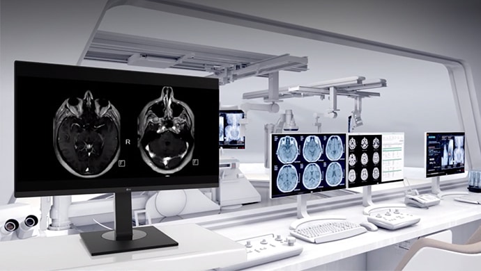 Video thumbnail :  LG Medical Display Monitor für klinische Prüfungen : 27HJ712C, 27HJ713C, 19HK312C