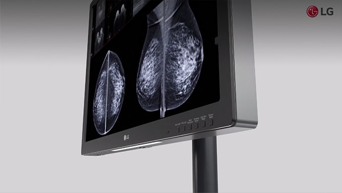 Video-Thumbnail: LG Diagnosemonitor für Mammographie
