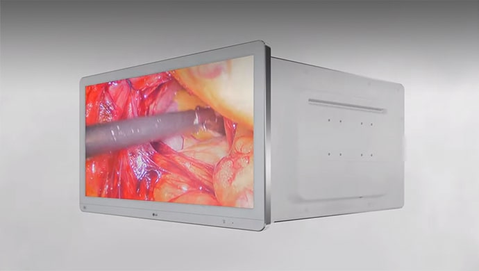 Video-Thumbnail: Einführung in Chirurgische Monitore von LG