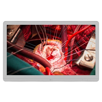 LG 8 MP kirurgisk monitor1