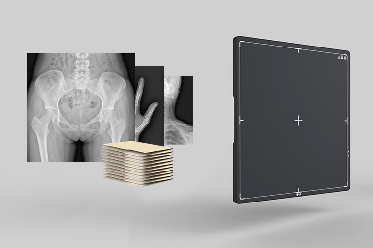 Almacenamiento en el detector digital de rayos X.