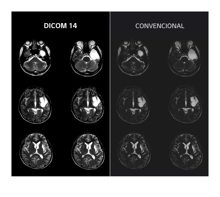 Imágenes estables en escala de grises