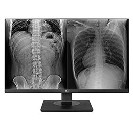 Monitor Clínico de Revisión 8MP2