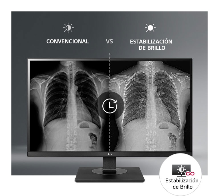 Pantalla Constantemente Estable2