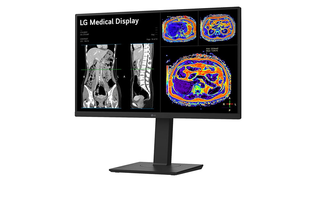 LG Monitor de revisión clínica 27'', Panel IPS, 8MP, sensor de calibración desmontable, 178º Ángulo de Visión, prednji prikaz, 27HS713C-B