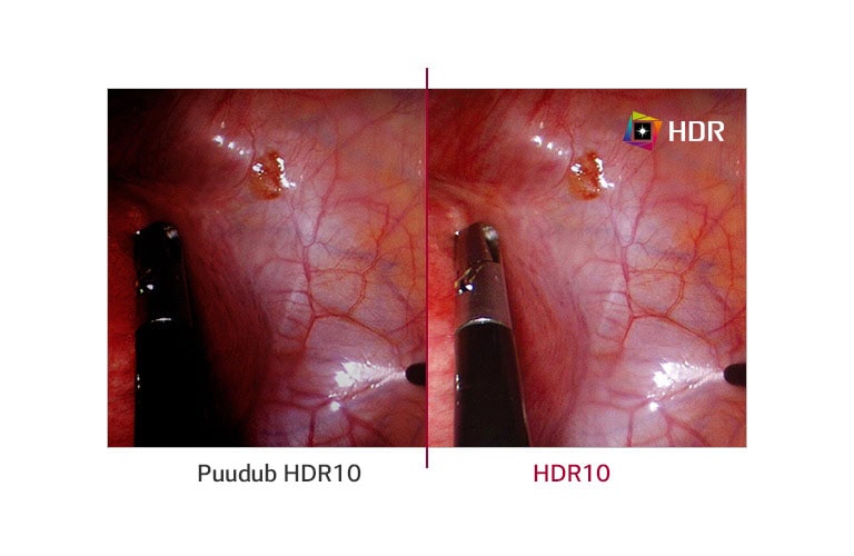 Toetab HDR10