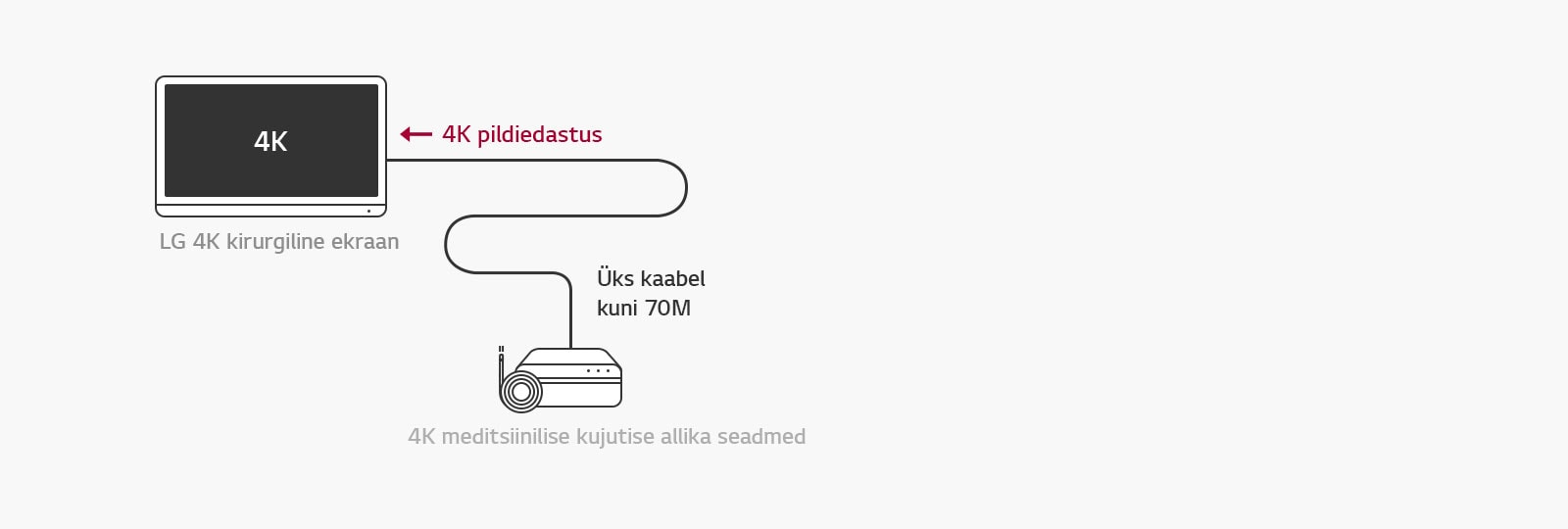 12G-SDI tugi : LG 4K kirurgiline ekraan võimaldab stabiilse operatsiooni jaoks 4K-signaalide kaugedastamist ühe koaksiaalkaabli kaudu ilma latentsusajata. 