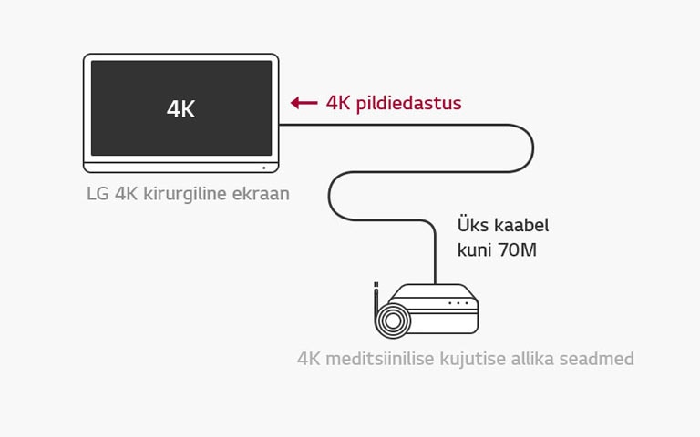 12G-SDI tugi : LG 4K kirurgiline ekraan võimaldab stabiilse operatsiooni jaoks 4K-signaalide kaugedastamist ühe koaksiaalkaabli kaudu ilma latentsusajata. 