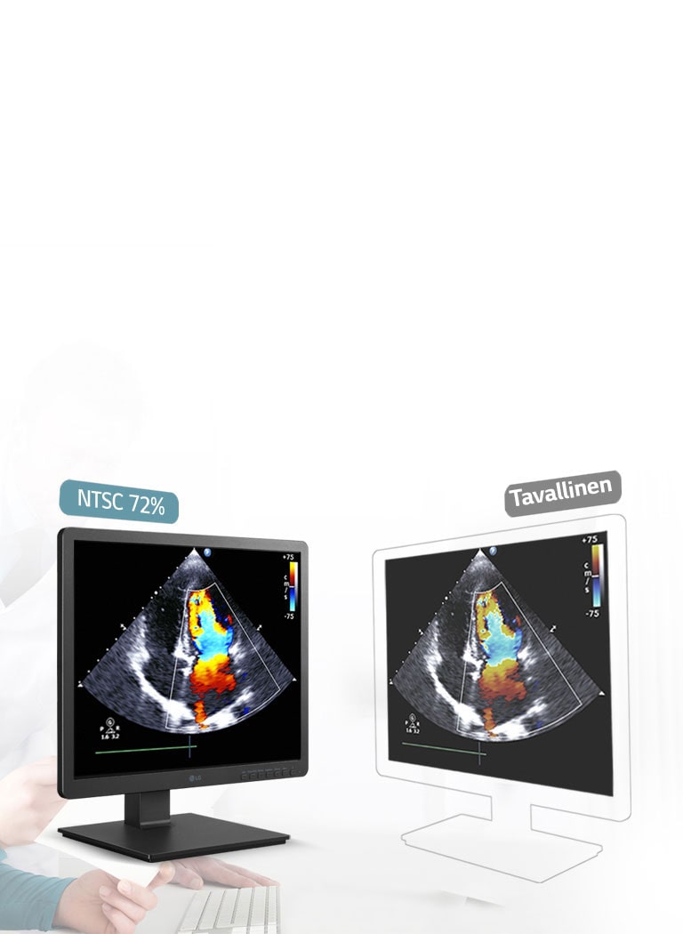 330 nitiä ja NTSC 72%, tarkka resoluutio1