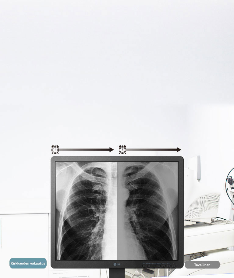 Kirkkauden vakautus1