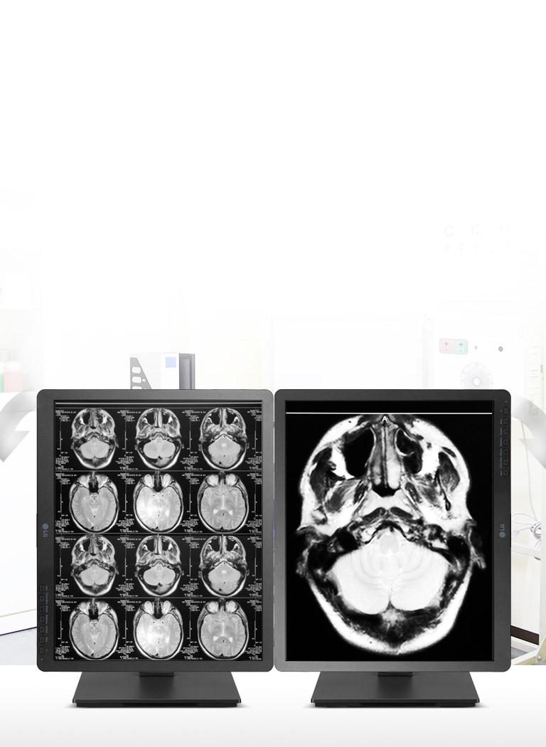 Kaksisuuntainen kääntö1