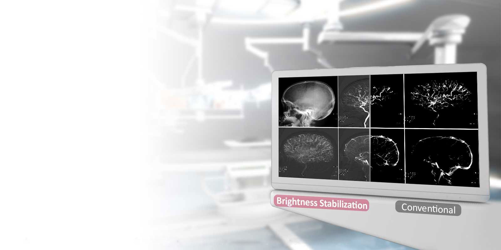 DICOM osa 14 ja<br>Kirkkauden vakautus1