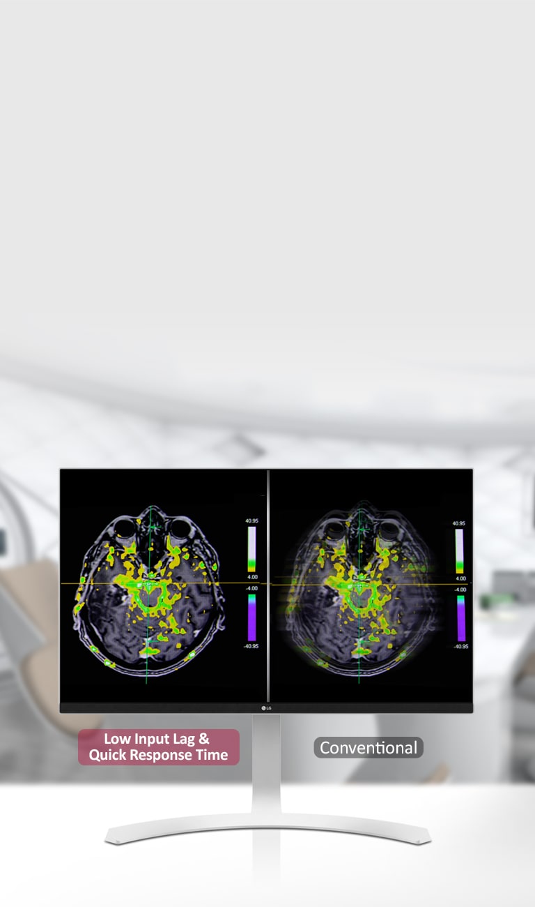Dynaaminen synkr.tila ja nopea vasteaika2