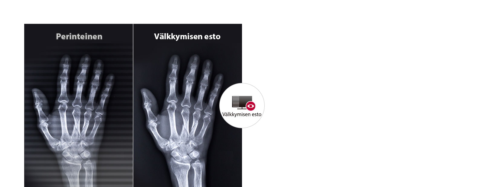 Pitkäkestoinen mukavuus silmille1