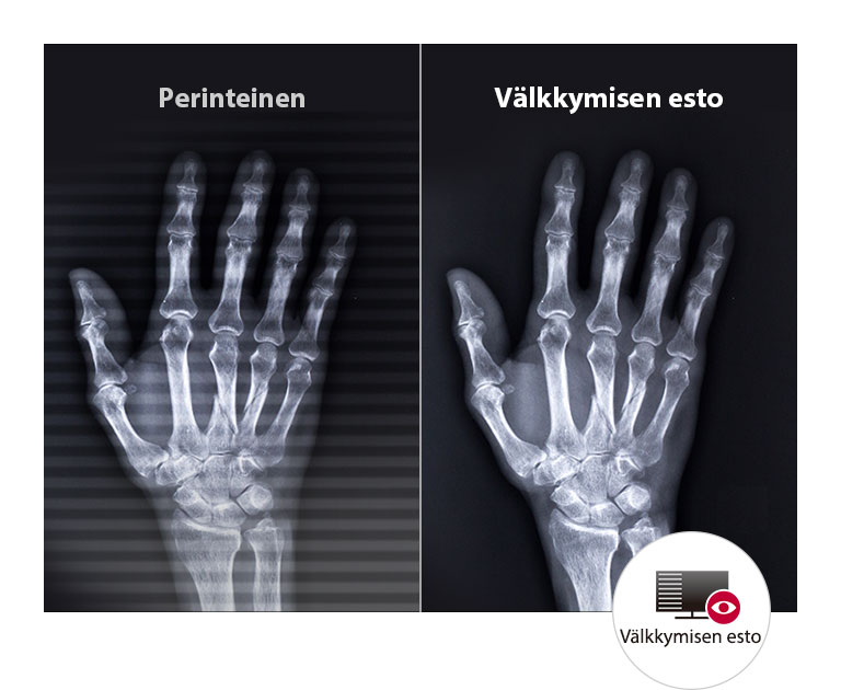 Pitkäkestoinen mukavuus silmille2