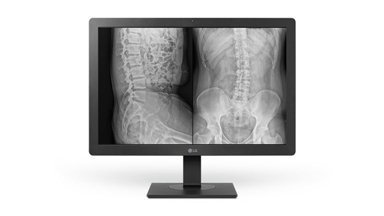 24HR513C sisältää Automaattisen luminanssianturin, joka asettaa näytön kirkkauden ympäristön valaistuksen mukaan.