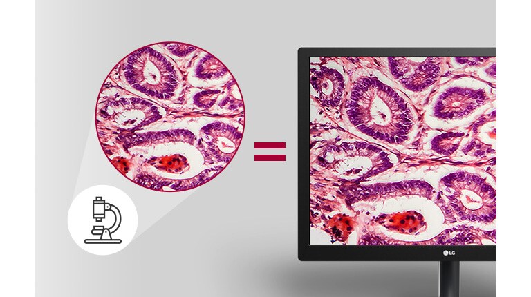 patologiatila tuottaa yhtä yksityiskohtaisia ja väriltään tarkkoja kuvantamistuloksia kuin mikroskoopilla tarkasteltaessa