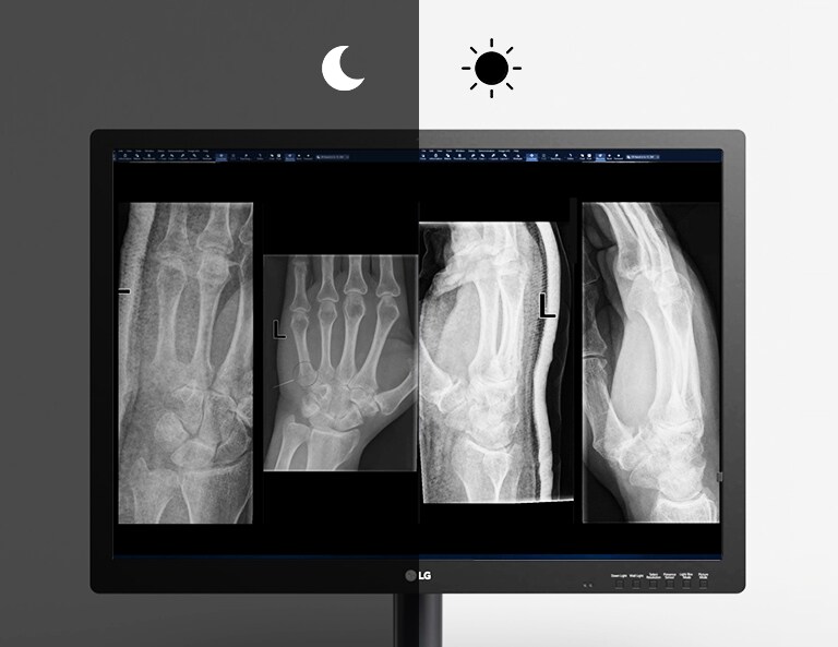 automaattinen luminanssianturi säätää näytön kirkkauden automaattisesti ihanteelliselle tasolle ympäristön valaistusolosuhteiden mukaan