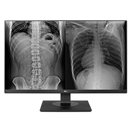 LG 27" 8MP kliininen arviointinäyttö2