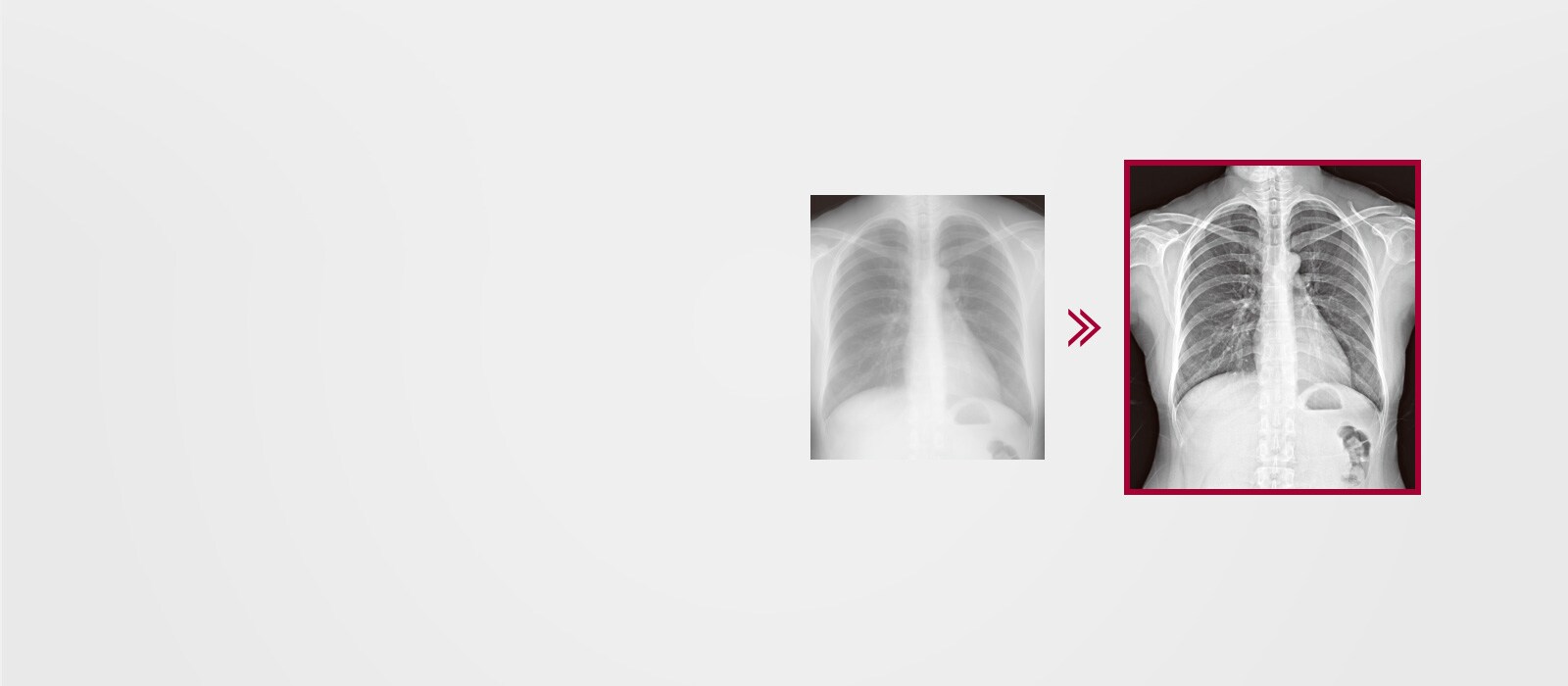 The more finely detailed image result using Multi-layer Image Processing embedded in the AWS, comparing to the image result without Multi-layer Image Processing