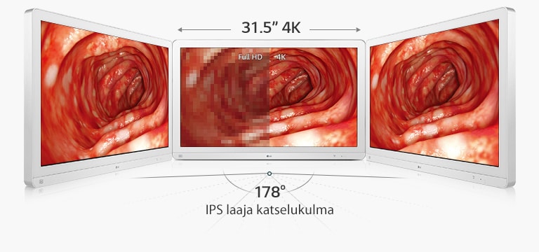 31,5"" 4K : Full HD 4K, IPS laaja katselukulma: 178 °