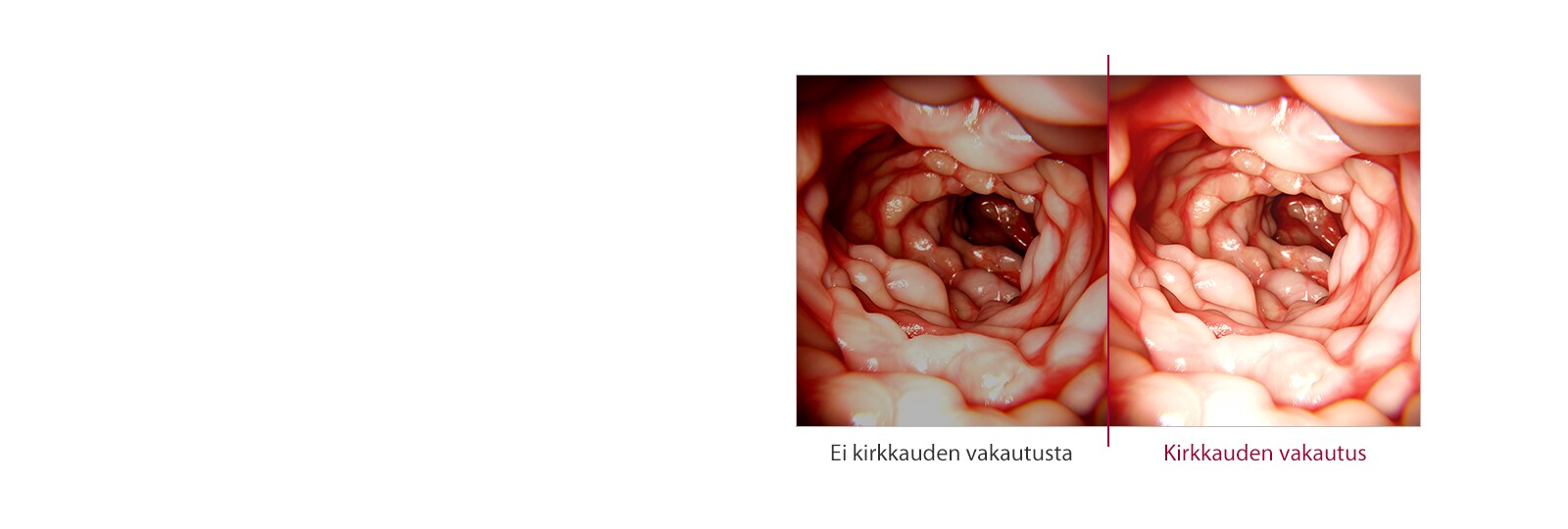Ei kirkkauden vakautusta vs. Kirkkauden vakautus 