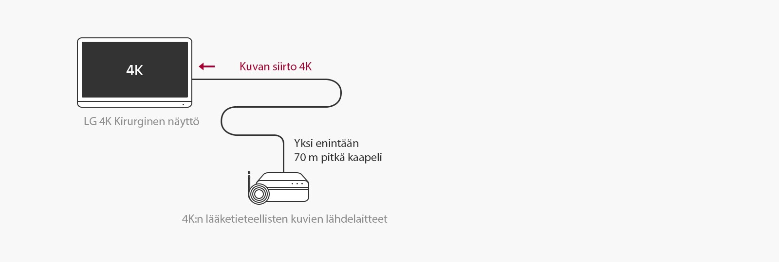 12G-SDI-tuki: Kirurginen LG 4K -näyttö mahdollistaa 4K-signaalien siirron pitkillä etäisyyksillä käyttäen yhtä koaksiaalikaapelia ilman viiveitä vakaata kirurgiaa varten. 