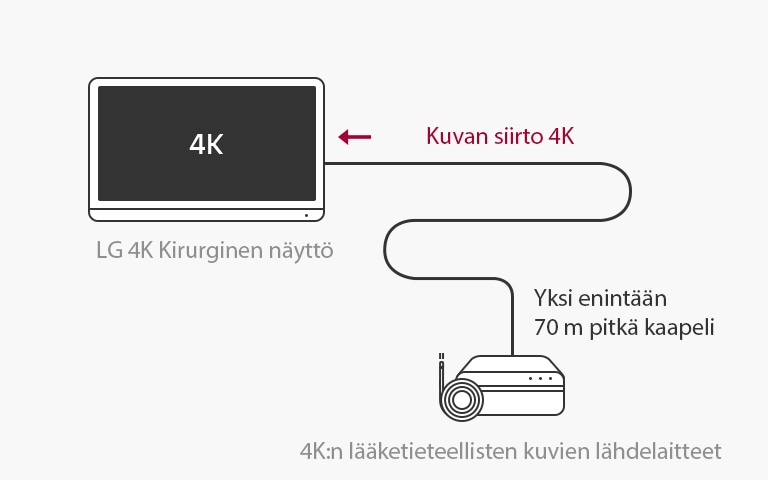 12G-SDI-tuki: Kirurginen LG 4K -näyttö mahdollistaa 4K-signaalien siirron pitkillä etäisyyksillä käyttäen yhtä koaksiaalikaapelia ilman viiveitä vakaata kirurgiaa varten. 