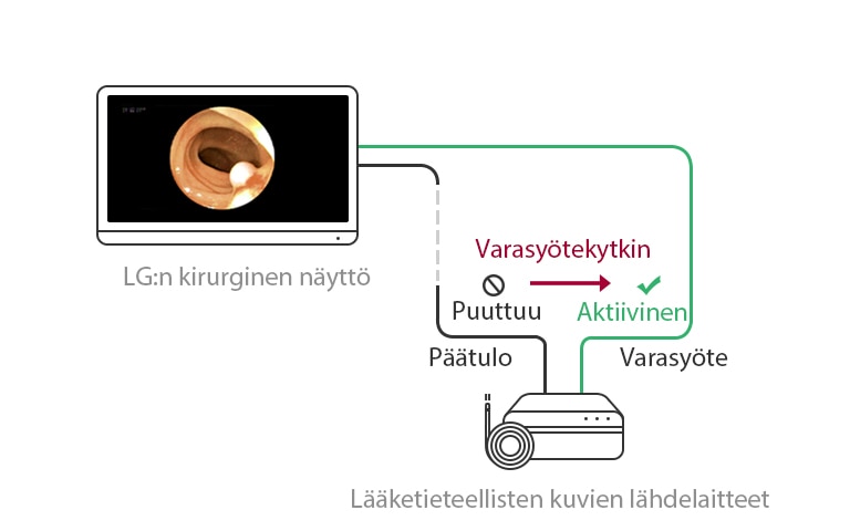 Varasyötekytkin: Kun päälähde puuttuu, näyttö siirtyy automaattisesti varalähteeseen ja palauttaa päälähteen käyttöön signaalin palauduttua.