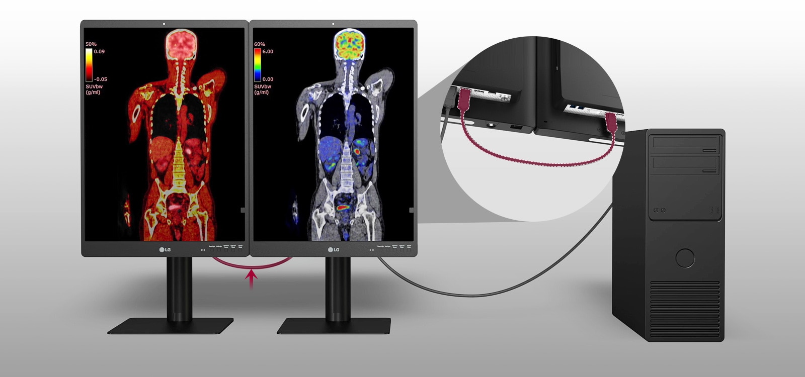 tuottava työasema yhdistämällä kaksi diagnostiikkanäyttöä ja PC.