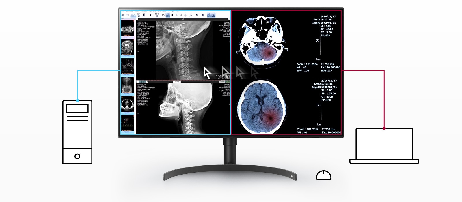 Multiple Signals on One Screen