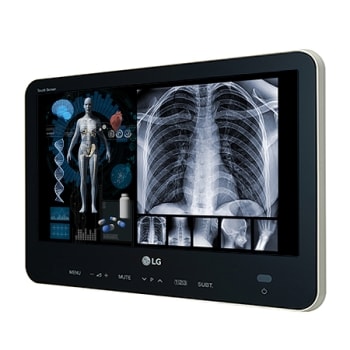 15" Intuitive Multi-touch Display1