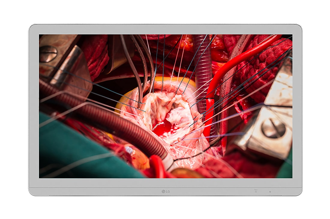 LG  LG 27'' 4K IPS Surgical Monitor, 27HJ710S-W