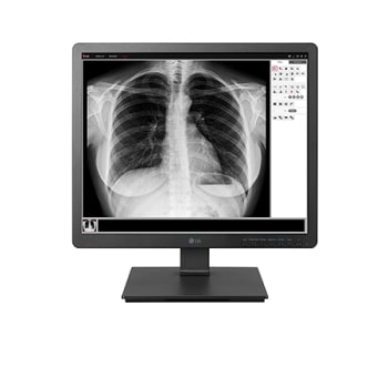 LG 19.3'' 1.3MP IPS Clinical Review Monitor1