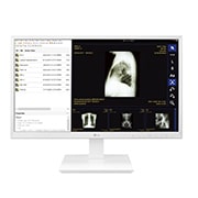 LG 24'' All-in-One Thin Client for Healthcare, 24CK560N, thumbnail 1