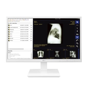 24" All-in-One Thin Client for Healthcare1