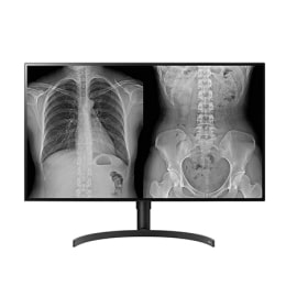 LG 8MP Diagnostic Monitor2