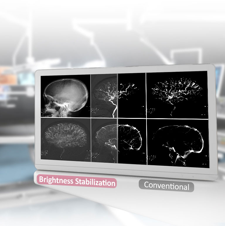 DICOM Part 14 & Brightness Stabilization 