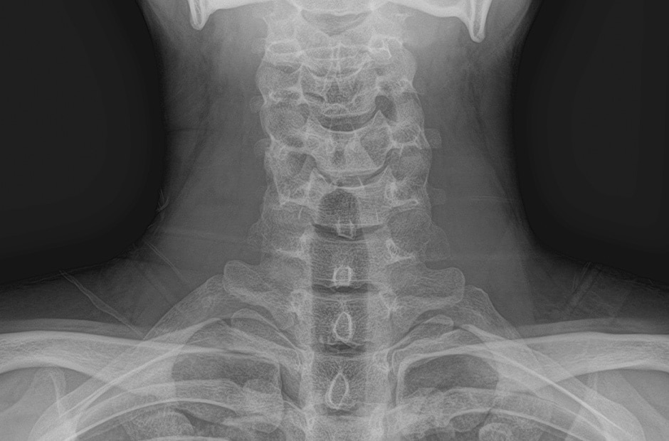 Hình ảnh X-quang 1.