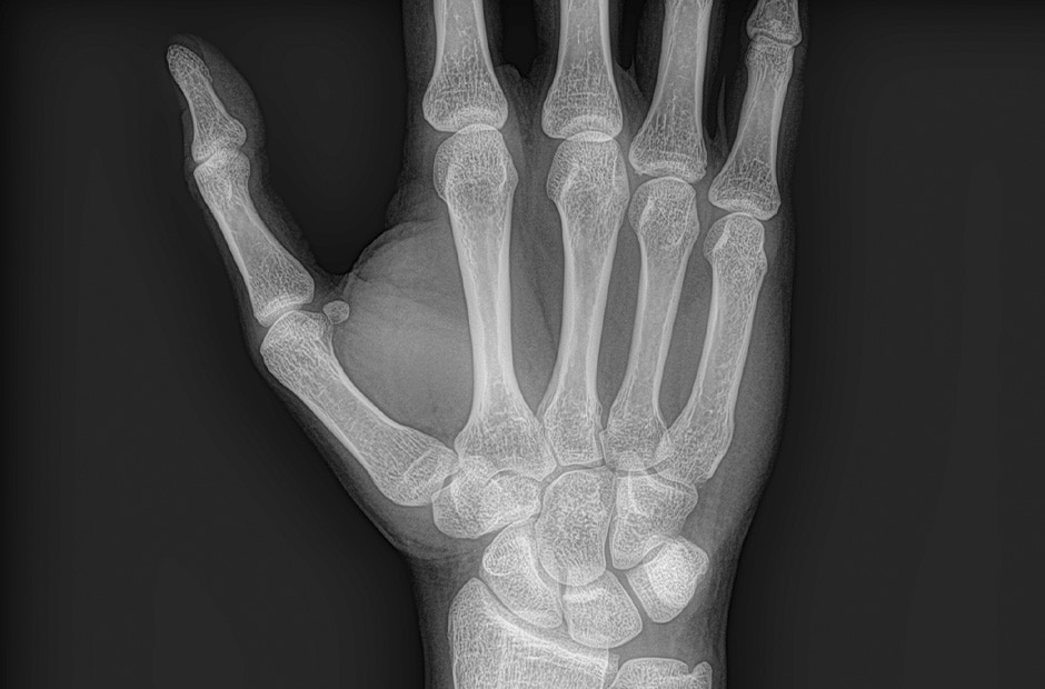 Hình ảnh X-quang 4