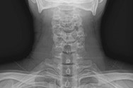 X-ray image 1.