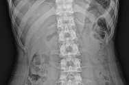 X-ray image 3