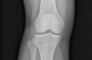 X-ray image 5