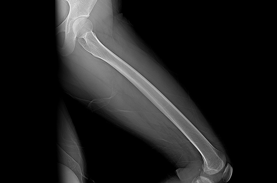 high resolution and clear diagnostic imaging results from using LG DXD